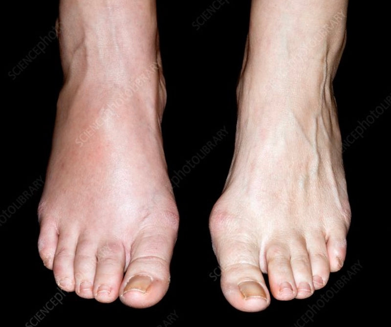 OTS pedi care