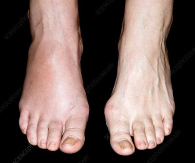 OTS pedi care